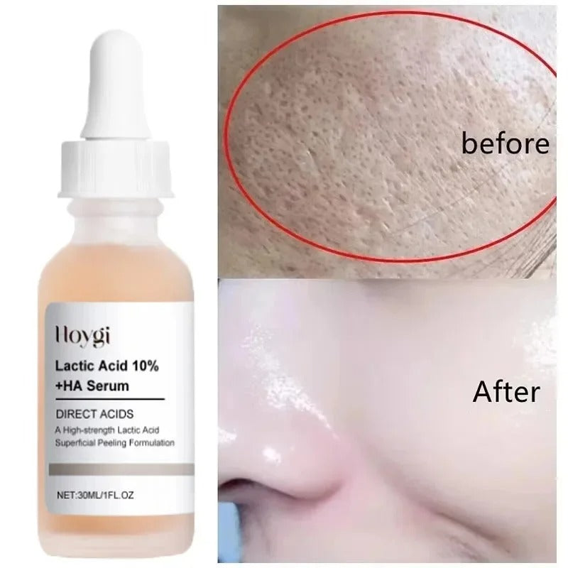 Lactic Acid Pore-Refining Serum